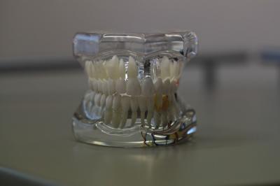centre dentaire strasbourg